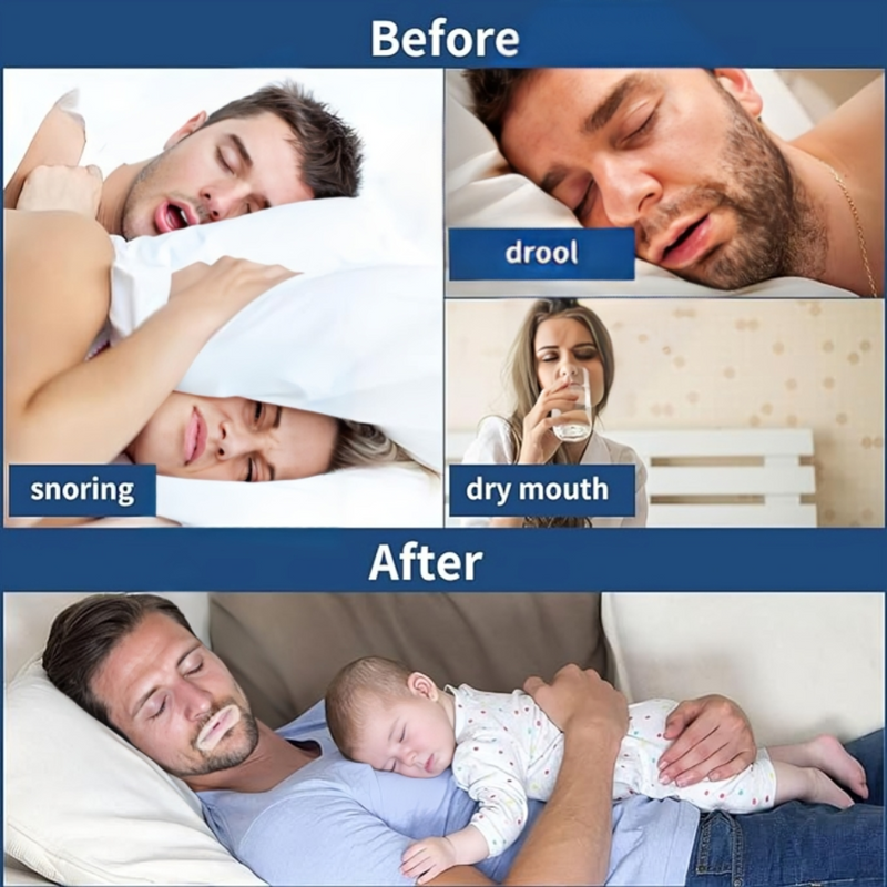 Sleeping Mouth Strips